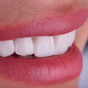 pressed and layered veneer - premium veneer